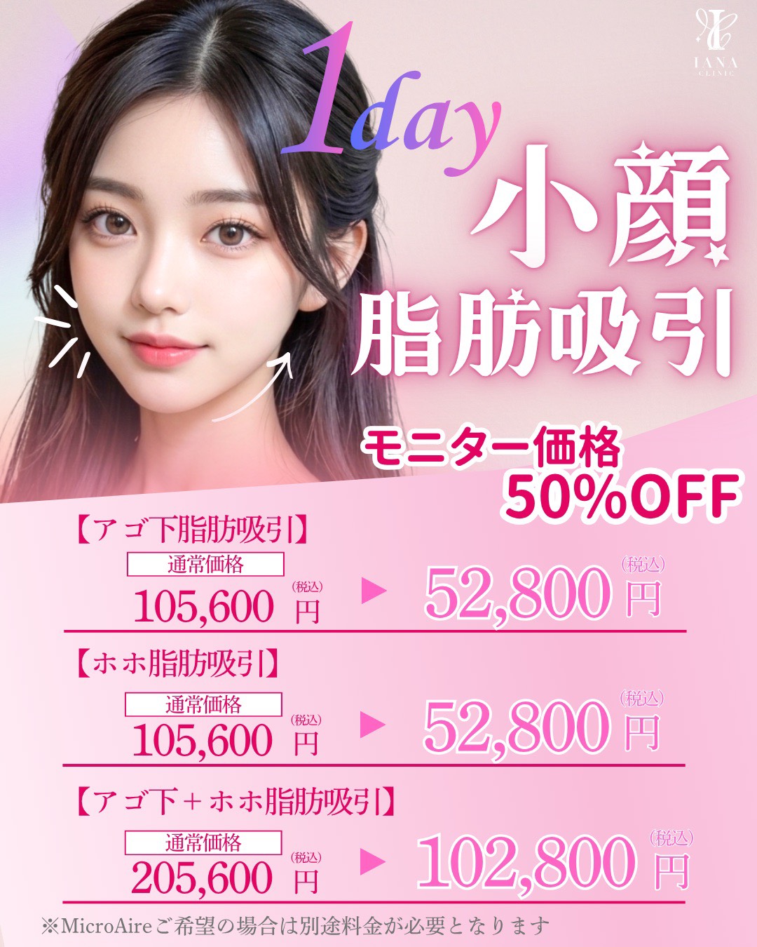1day 小顔脂肪吸引